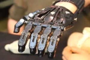 $50 3D Printed Hand to a $42,000 Prosthetic Limb?